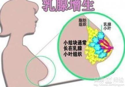 呼和浩特乳腺增生症不要怕