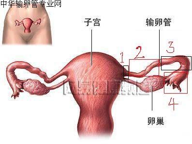 女性应该怎么预防急性输卵管炎